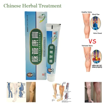 10vnt Kinijos natūralių augalinių vaistų gydyti venų kraujagyslių uždegimas masažo kremas išgydyti išsiplėtusių venų tepalas