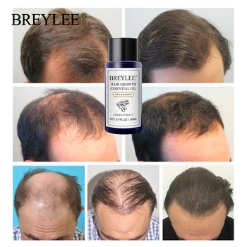 BREYLEE Plaukų Augimą eterinis Aliejus 2VNT Greitai Galingas Plaukų priežiūros Produktai, Plaukų Priežiūra Kelią Nuplikimas, Plaukų slinkimo Serume Padidėjimas, Plaukų
