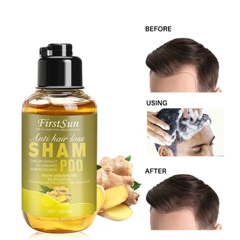 Imbiero Sultys Plaukų Šampūnas Profesionali Plaukų Galvos odos Gydymas Oil Control Plaukų Augimą, Tankus, Stabdžių Plaukų slinkimo Anti Niežulys 100ML
